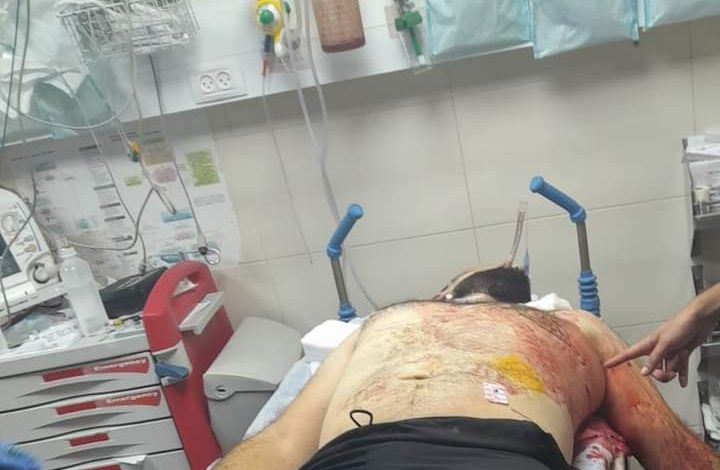 مقتل المواطن محمد الخضر من قوصين بنابلس خلال شجار عائلي