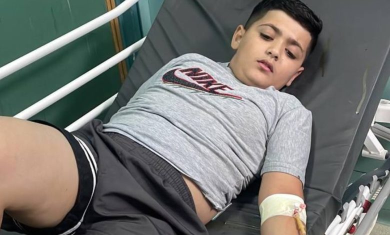 إصابة بإطلاق أجهزة السلطة النار صوب منازل المواطنين بجنين