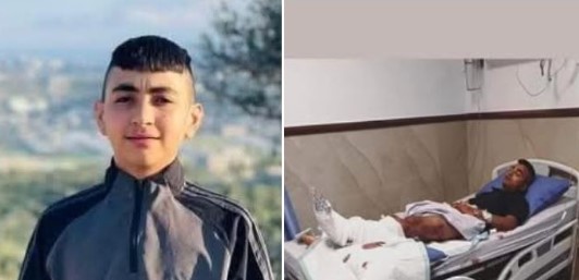 والد الطفل “العامر”: السلطة حاولت قتل ابني الثاني المصاب