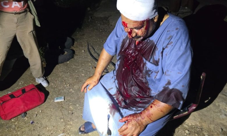 أهالي يطا: أين من يقولون عن أنفسهم “حماة الوطن” من اعتداءات المستوطنين علينا؟