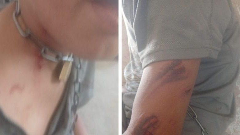 غضب شعبي واسع.. الاعتداء على طفل من ذوي الاحتياجات الخاصة في يطا