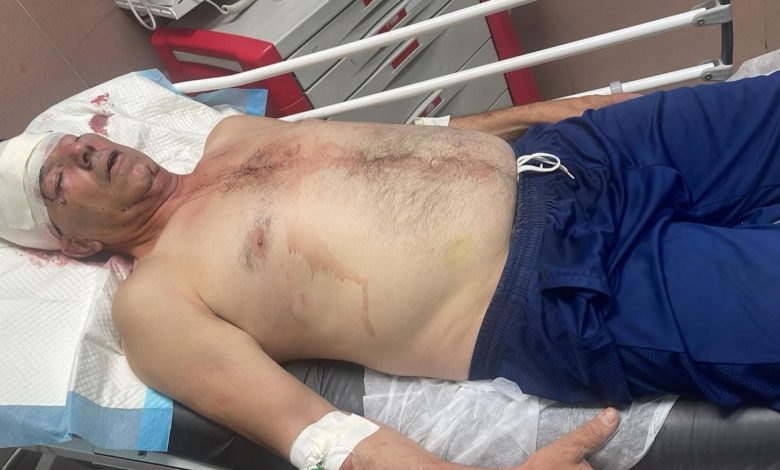 شرطة سلواد توفر الحماية لعصابة فتح المعتدية على البروفيسور جمال حرفوش